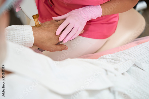 Laser hair removal on a man's arm in medical clinic
