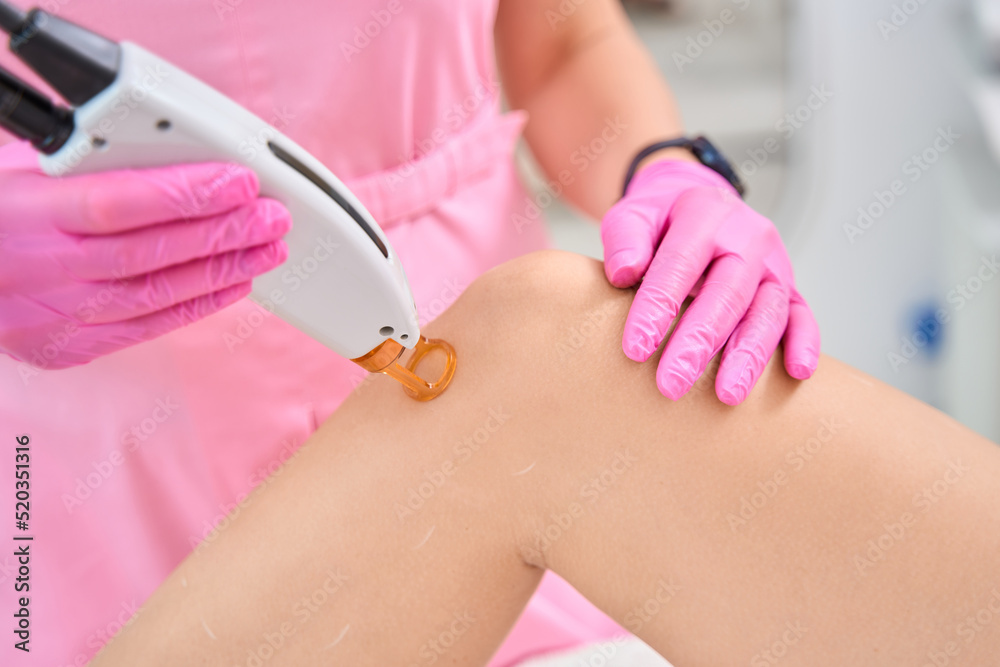 Doctor in medical uniform is performing laser hair removal procedure Doctor in medical uniform is performing laser hair removal procedure