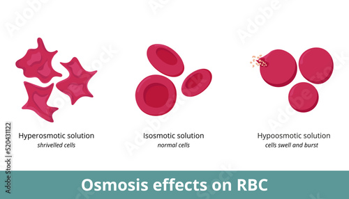 Osmosis effect on red blood cells. Depending on solution concentration (hyperosmotic, isosmotic, or hypoosmotic), erythrocytes can shrivel or swell and burst. photo