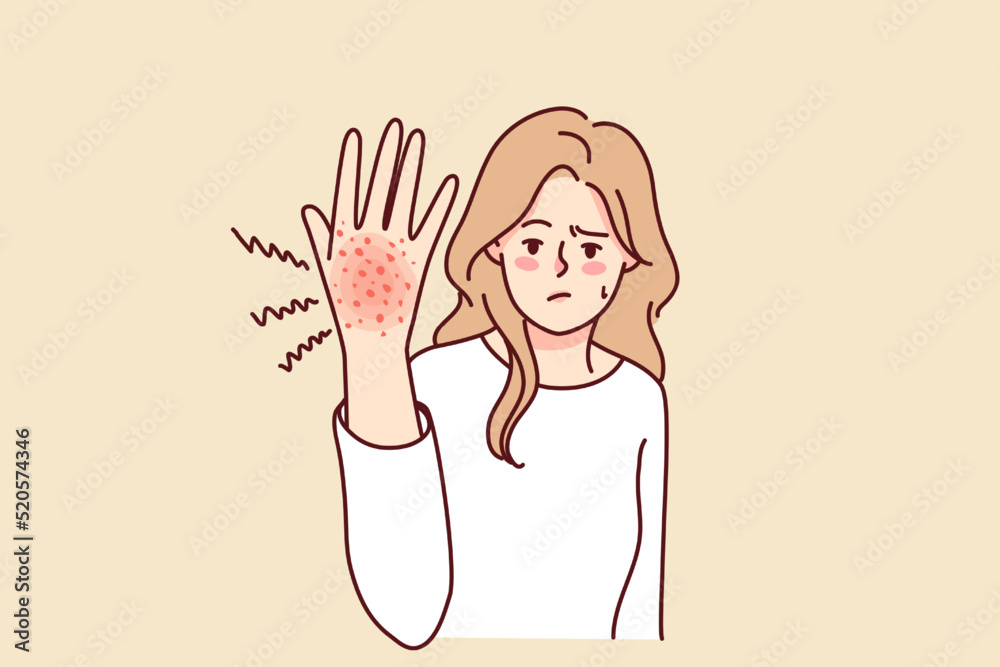 Unhappy woman suffer from redness on hand. Unwell girl struggle with psoriasis or seasonal allergy. Healthcare concept. Vector illustration. Unhappy woman suffer from redness on hand. Unwell girl struggle with psoriasis or seasonal allergy. Healthcare concept. Vector illustration.