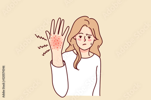 Unhappy woman suffer from redness on hand. Unwell girl struggle with psoriasis or seasonal allergy. Healthcare concept. Vector illustration. 