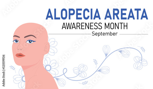 September is Alopecia Areata awareness month