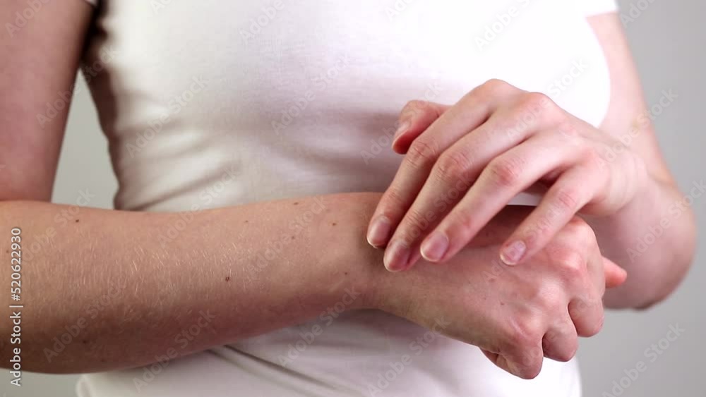 Applying pain relief cream, medical ointment on hand wrist trauma Applying pain relief cream, medical ointment on hand wrist trauma
