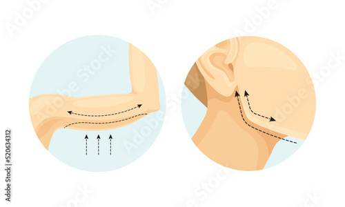 Plastic Surgery for Arms and Face as Restoration and Reconstruction of Human Body in Circle Vector Set