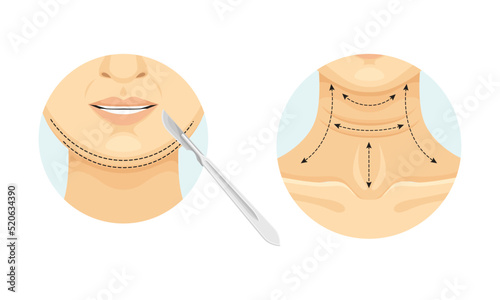 Plastic Surgery for Chin and Neck with Stipple Line as Restoration and Reconstruction of Human Face in Circle Vector Set