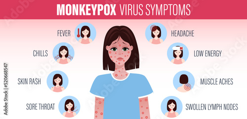 Monkeypox virus Symptoms. New cases of Monkeypox virus are reported in Europe and USA. Monkeypox is spreading in the Europe. It cause skin infections. Monkeypox virus Symptom infographics