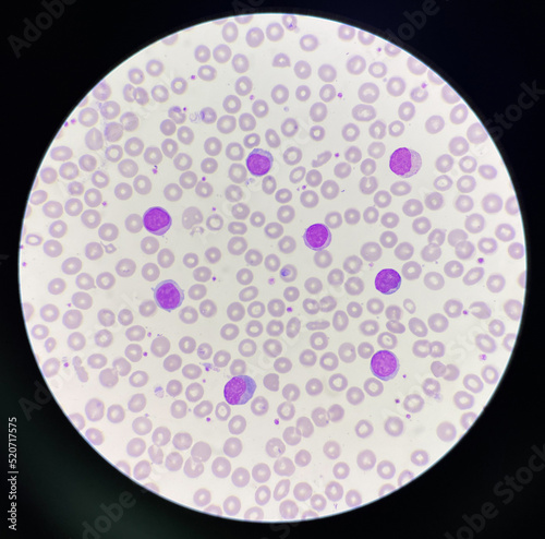 Many lymphocyte on red blood cells background.