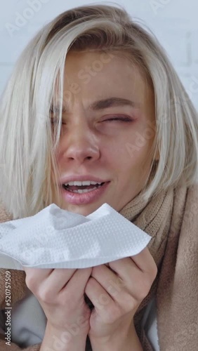 vertical video of sick young woman sneezing in tissue at home