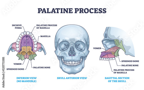 Palatine process section anatomy with maxilla structure outline diagram. Labeled educational facial skeletal bone description with incisive fossa, vomer, sphenoid and palatine vector illustration.