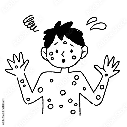 サル痘　男性　イラスト　白黒