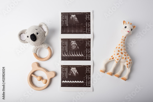ultrasound shot with children's toys. Concept of expecting a baby