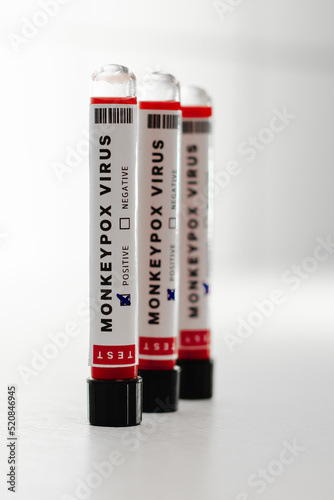 Monkeypox Virus Blood Test in Laboratory 