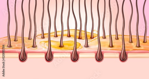 3d illustration of dry scalp and normal hair. Dry skin, dermatitis, seborrhea. photo