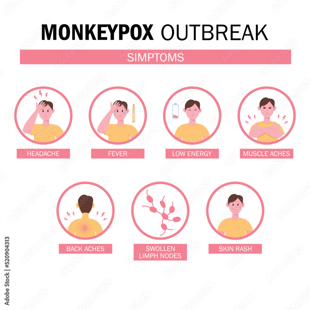 Monkeypox virus Symptoms. New cases of Monkeypox virus are reported in Europe and USA. Monkeypox is spreading in the Europe. It cause skin infections. Monkeypox virus Symptom infographics