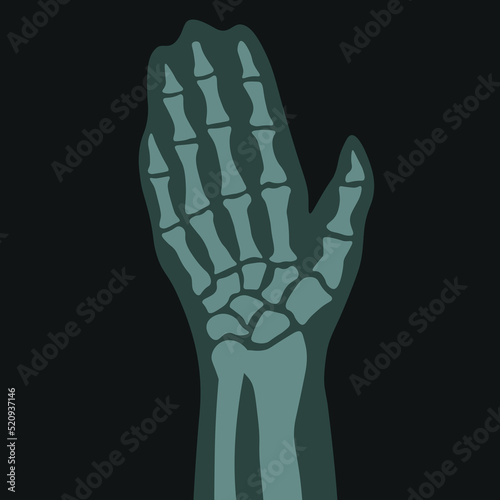 Xray of hand, palm with fingers, roentgen scan