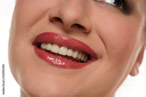 Smile of a woman with porcelain teeth