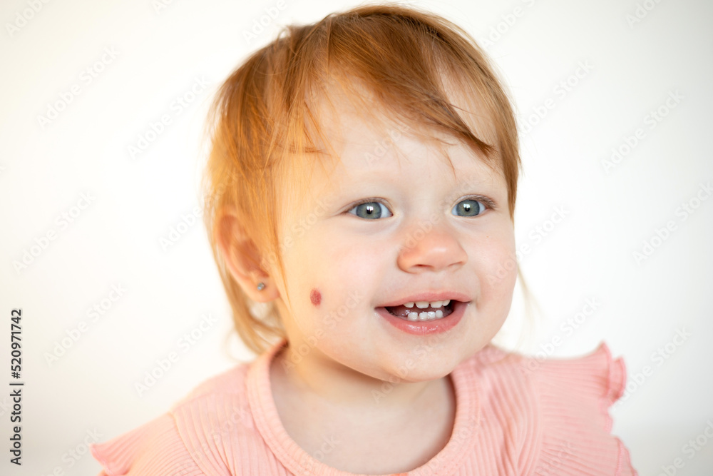 Portrait of a charming funny red-haired baby girl with blue eyes and a birthmark on her cheek. Hemangioma. Light background. Lifestyle Portrait of a charming funny red-haired baby girl with blue eyes and a birthmark on her cheek. Hemangioma. Light background. Lifestyle
