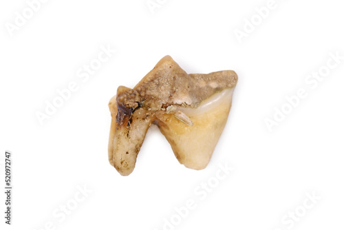Quadro em tela Dark rot on surgically removed sick premolar cat tooth