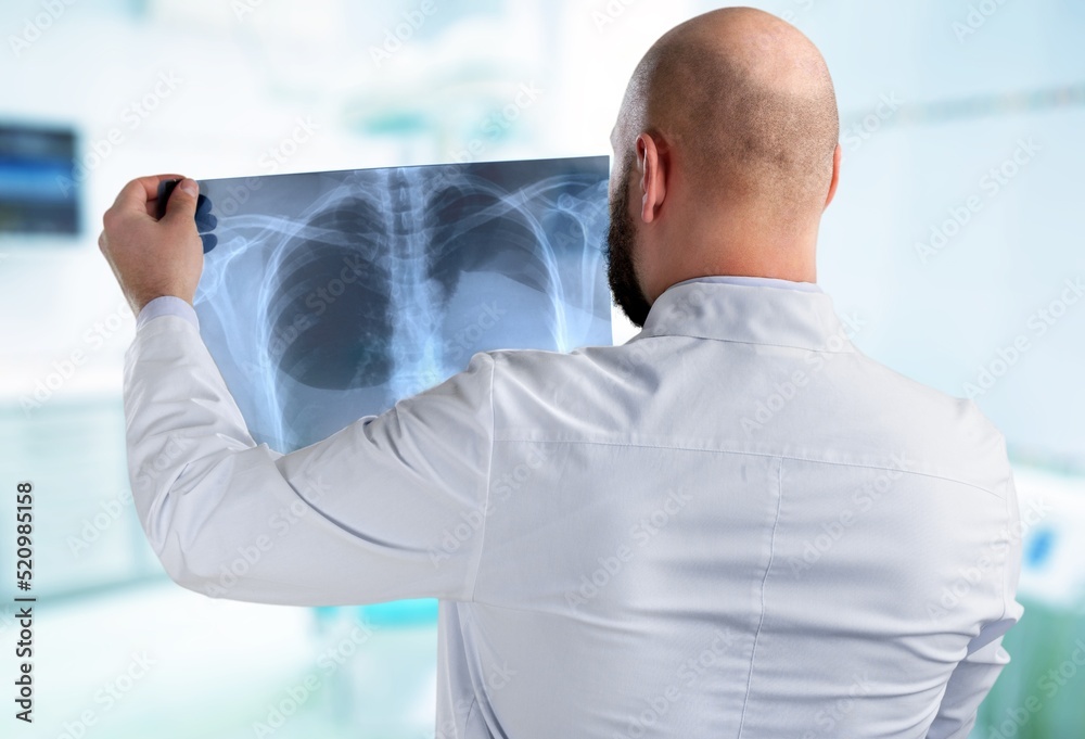 Fototapeta premium A surgeon doctor examining patient's x-ray films, scan in at radiology unit, hospital background. healthcare and medicine concept