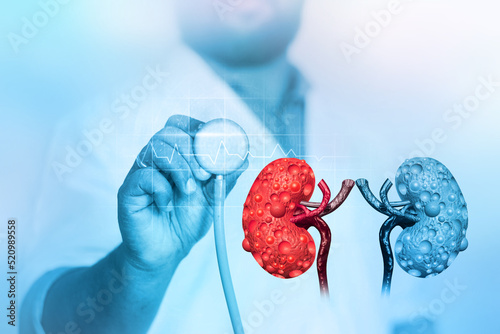 Doctor check and diagnose the diseased kidney on medical background. 3d illustration photo