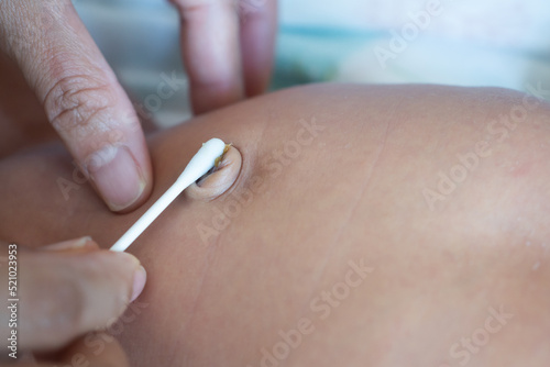 Mother use cotton swab moistened with alcohol to wipe clean the navel umbilical cord baby newborn.Treatment of newborn baby navel with a cotton swab