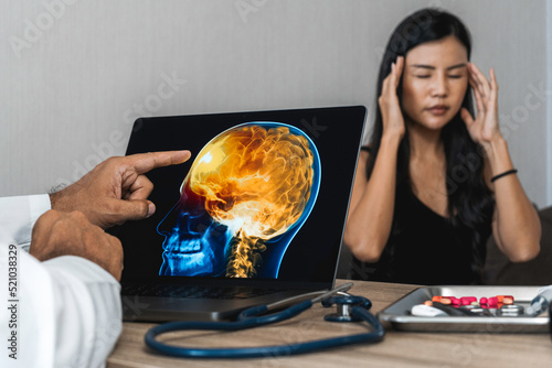 Doctor showing a x-ray of pain in the brain on a laptop. Migraine Headache