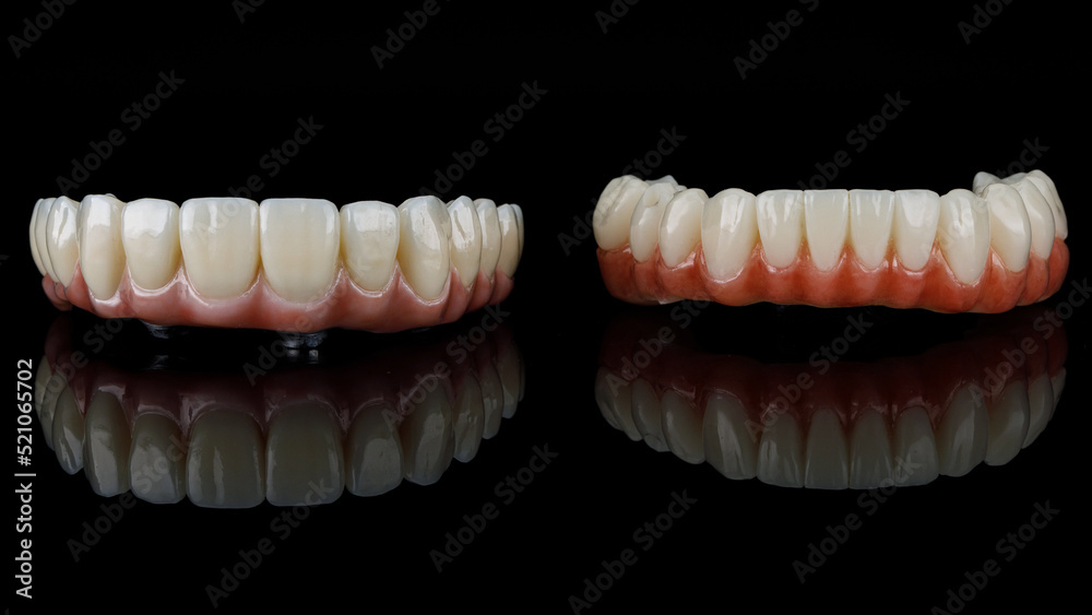 two dental prostheses of the upper and lower jaws with gums and relief of teeth on black glass with reflection two dental prostheses of the upper and lower jaws with gums and relief of teeth on black glass with reflection
