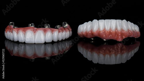 two excellent dental prostheses made of zircon and titanium on a black background with reflection