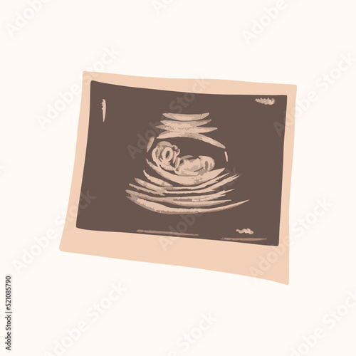 Ultrasound of a child in the womb, printed on paper. Vector illustration.