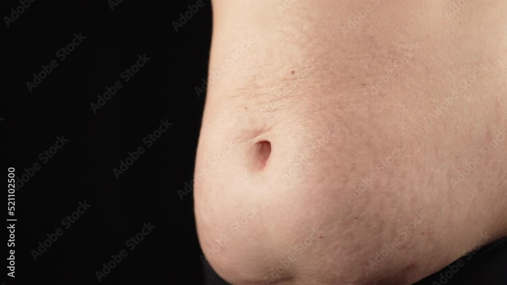 Woman belly during breathing exercises bodyflex. Showing stretch marks