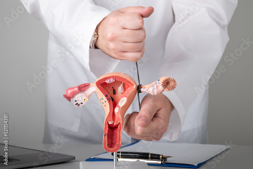 Gynecologist shows how to ligate the fallopian tubes on training model of female reproductive system photo