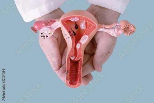 doctor Gynecologist holds model of female reproductive system in the hands. Help and care concept photo