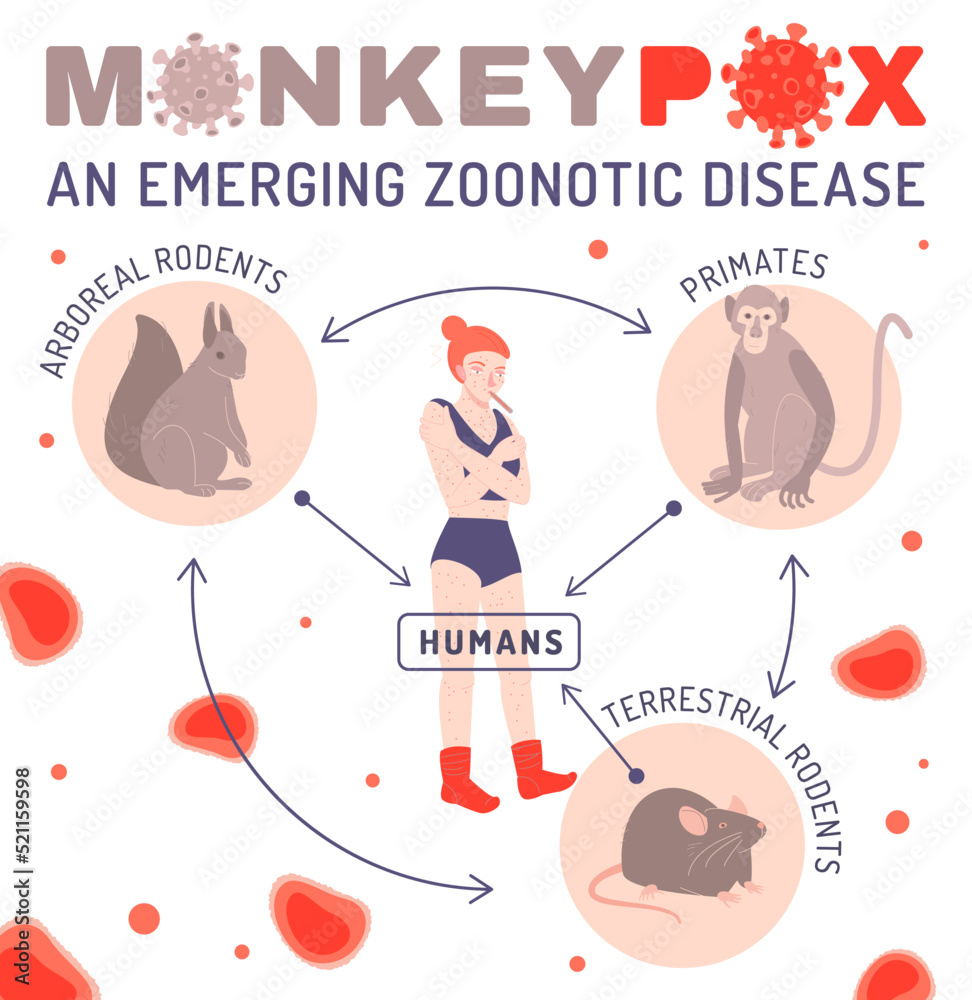 Fototapeta premium Monkeypox virus banner. Useful information. Vector illustration