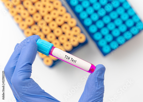 Thyroid stimulating hormone (TSH)  test result with blood sample in test tube on doctor hand in medical lab photo