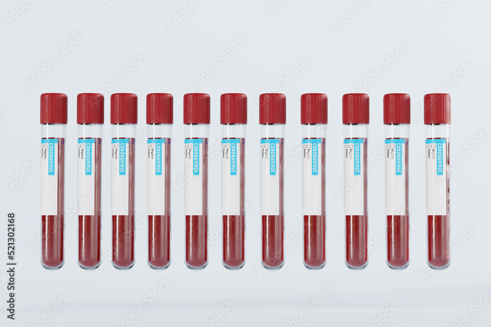 Blood samples for the Coronavirus COVID Test. The concept of the coronavirus pandemic, the new wave of infections. COVID diagnosis. 3D render, 3D illustration. Blood samples for the Coronavirus COVID Test. The concept of the coronavirus pandemic, the new wave of infections. COVID diagnosis. 3D render, 3D illustration.
