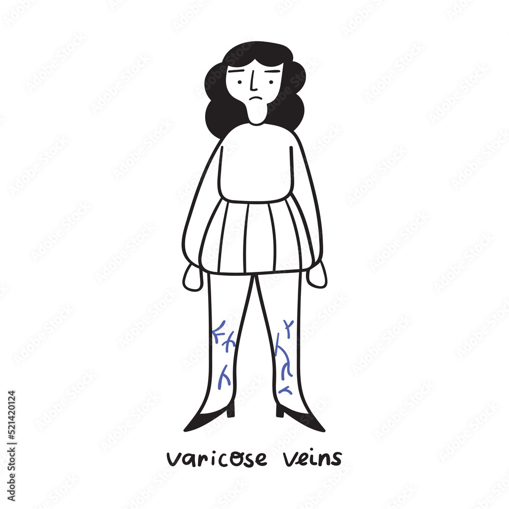 Sad woman has varicose veins. Vector outline illustration on white background. Sad woman has varicose veins. Vector outline illustration on white background.