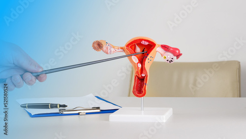 doctor gynecologist pointing model of female reproductive system on his desktop photo