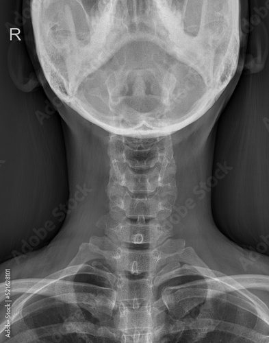 Human neck CT scan image