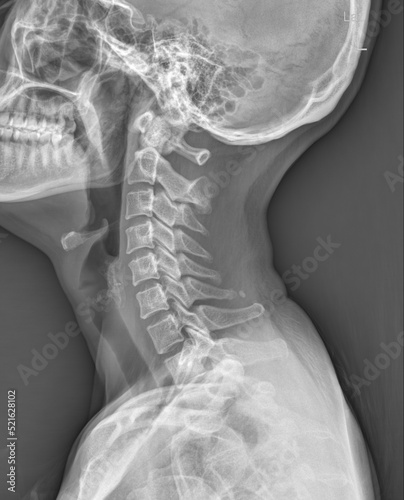 Human neck CT scan image