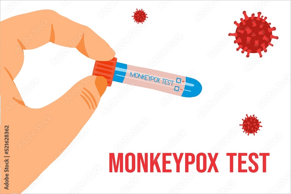 Monkeypox virus test. Monkeypox infection pandemic. Positive or