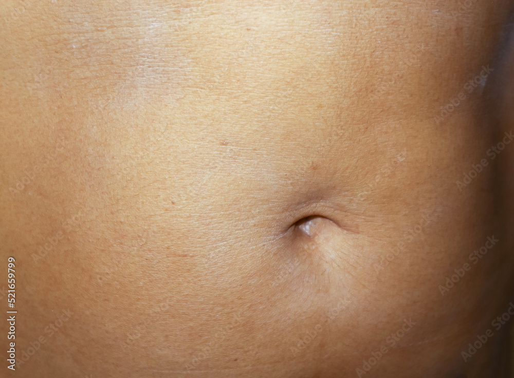Cover the skin with a nourishing cream for dry and rough abdomen. Cover the skin with a nourishing cream for dry and rough abdomen.