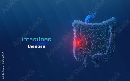 Human intestinal organ, health problems or severe illness. Hospital medical service concept. made in a wireframe style of dots and plexuses photo