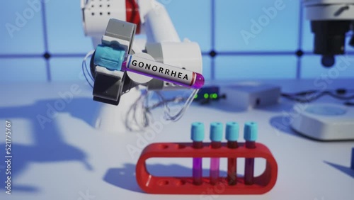 Gonorrhea Robot and a test tube with a blood sample for microbiological analysis in the robot's hand. Futurological concept of medicine of the future photo