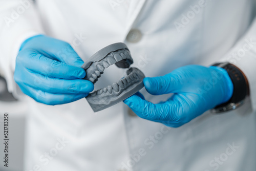 Upper and lower jaw of a man printed on a 3d printer of photopolymer photo