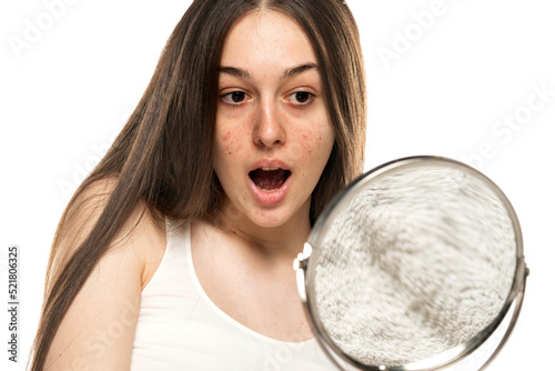 A shocked girl with problematic skin looks at herself in the mirror