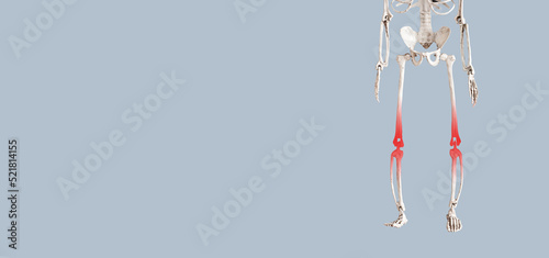 Banner with skeleton with red points at painful knees. Arthritis, infection, gout, leg injury consequences. Health problems, medical conditions concept. Copy space. High quality photo