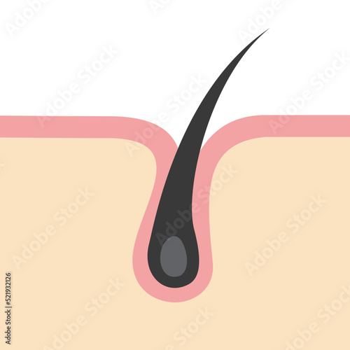 毛根のイメージイラスト
