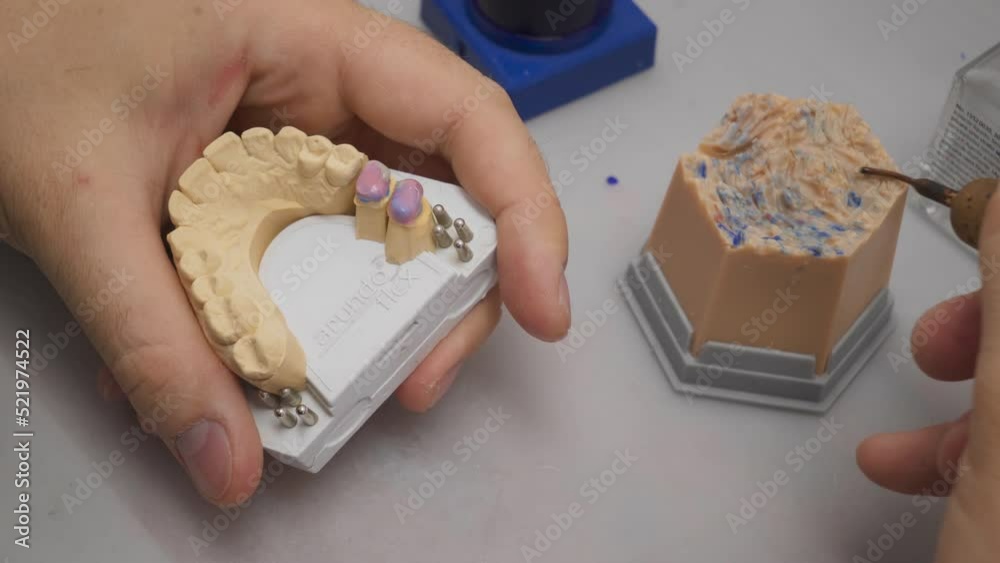 Dental crown manufacturing process at the modern clinic. Worker using