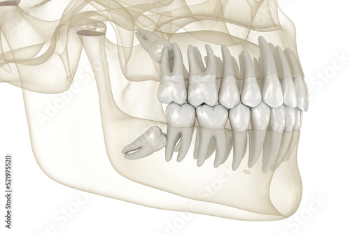 Mesial impaction of Wisdom teeth. Medically accurate tooth 3D illustration