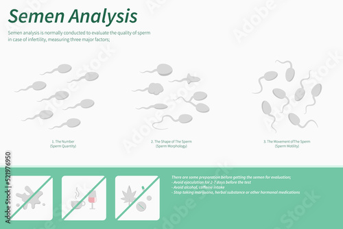 Semen Analysis horizontal infographic.ai horizontal infographic illustration about infertine healthcare and medical science vector.
